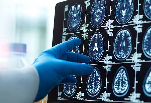 Best AI Tools For Analyzing X-Ray
